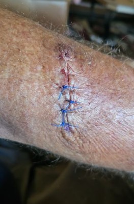 Left Arm (1) s.JPG
